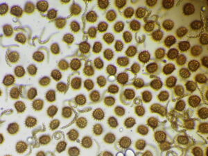 Fossombronia foveolata